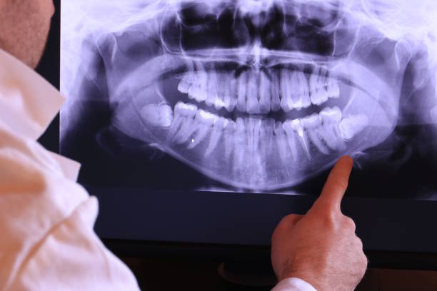 Best Cracked Tooth Emergency Dentist  in Alma, GA