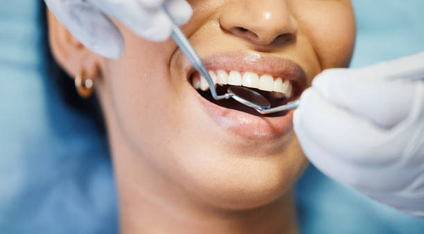 Best Chipped Tooth Repair Near Me  in Alma, GA