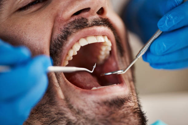 Best Chipped Tooth Repair Near Me  in Alma, GA